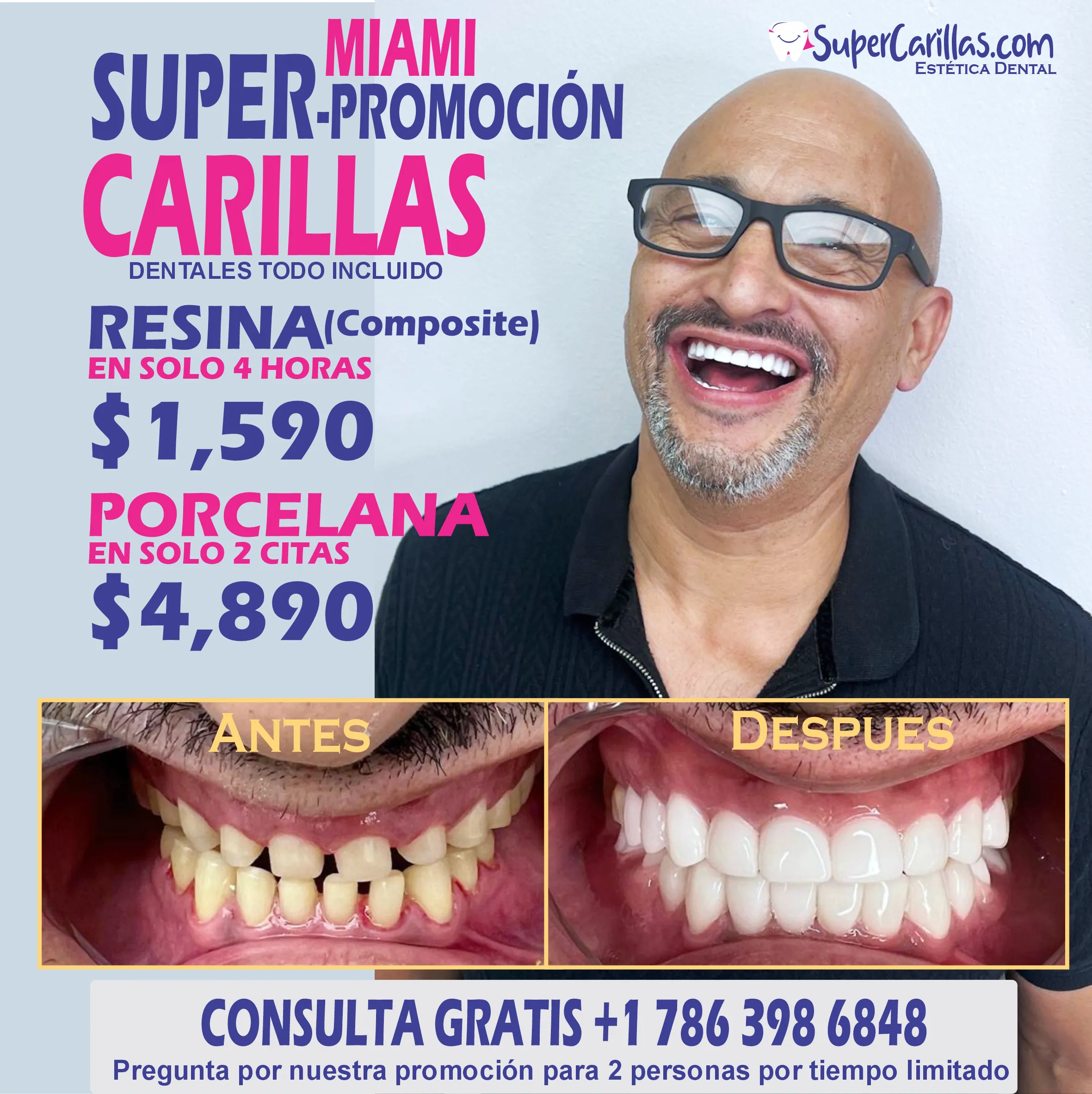 Carillas dentales en Miami, Florida